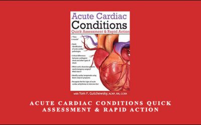 Acute Cardiac Conditions